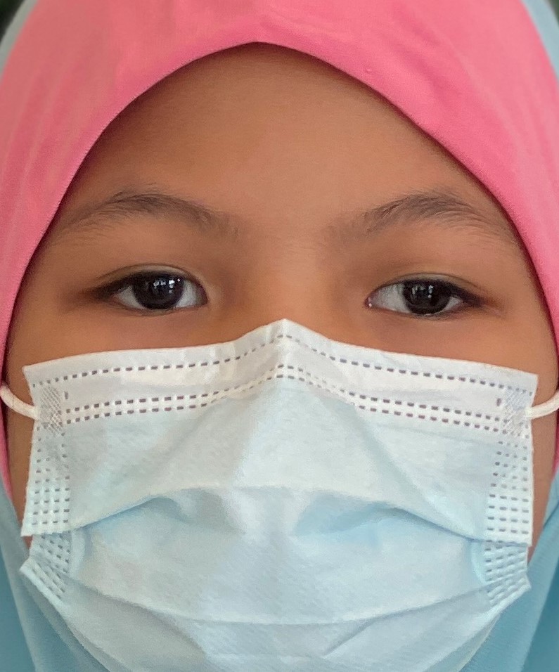 Dr Fiona's patient, 9-year-old Mia Syuhada binti Sabdani, prior to undergoing the squint surgery at Sunway Medical Centre Velocity (SMCV)